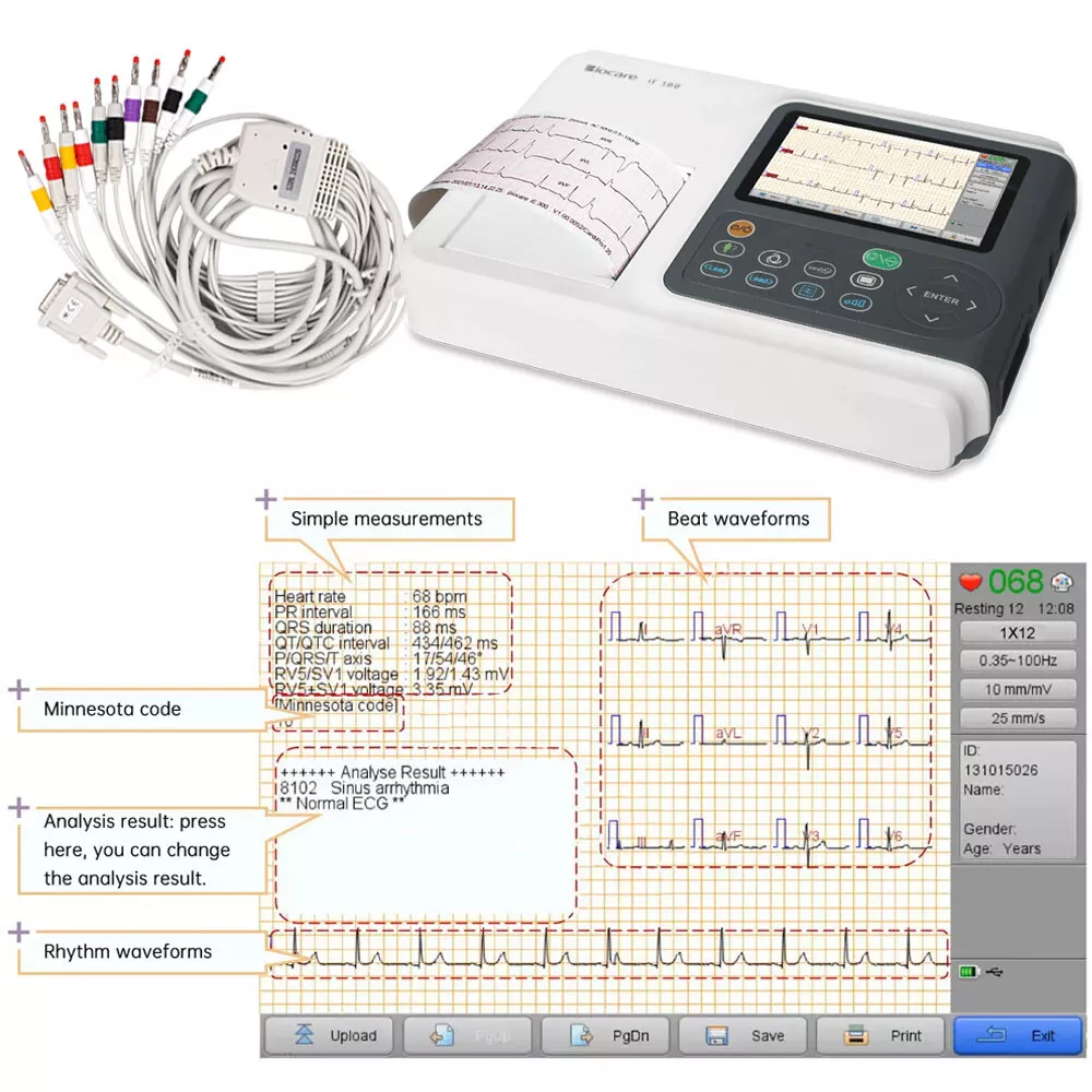 12 Lead ECG/EKG Machine w Interpretation Electrocardiograph Auto-analysed  Result