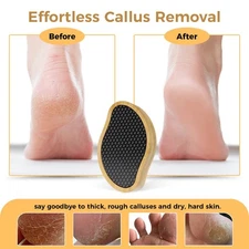 OUKEYA Professional Nano Glass Foot File (Remove Callus & Dead Skin) 1 Pcs