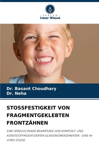 Basant Choudhary (U. A.) | Stossfestigkeit Von Fragmentgeklebten FrontzÄHnen-image