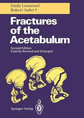 Fractures of the Acetabulum Buch Springer