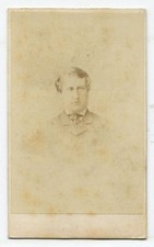 CROSSED EYED MAN. CDV. LIVERPOOL, ENGLAND. 