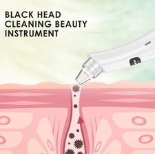 Electric Blackhead Remover Pore Vacuum Suction Face Cleaner