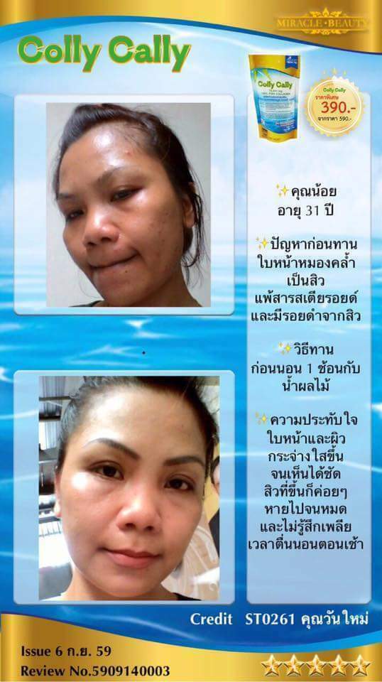 3 Colly Cally FISH COLLAGEN Drink Anti Aging Whitening Smooth Skin Aura ...