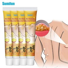Skin Tag Removal Treatment Cream Body Care Mole Corn Wart Remover
