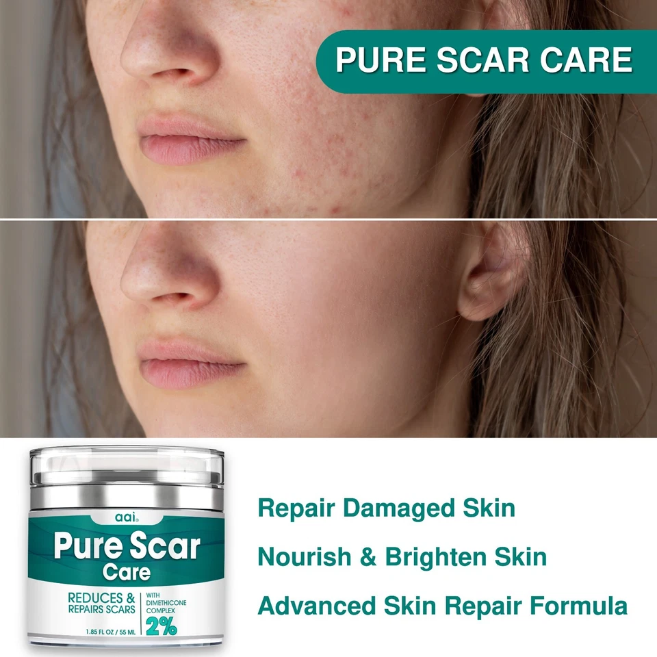 Scar Removal Advanced Cream Treatment Gel for Surgical Scars, Acne Scars, C-Sect - Image 3 of 4