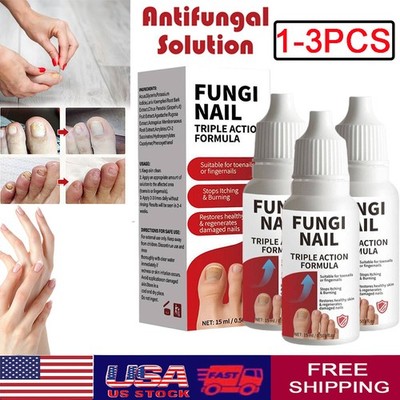 1-3PCS Fungi-Nail Anti-Fungal Liquid Solution Kills Fungus That Can Lead To Nail