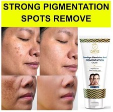 Anti-Pigmentation Blemishes Spots Removal Face Cream 100g For UNISEX Best Result