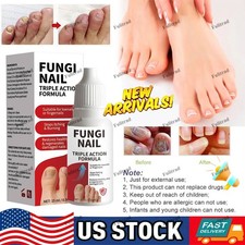 Fungi-Nail Anti-Fungal Liquid Solution Kills Fungus That Can Lead To Nail