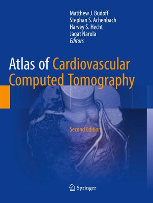 Matthew J. Budoff (u. a.) | Atlas of Cardiovascular Computed Tomography | Buch