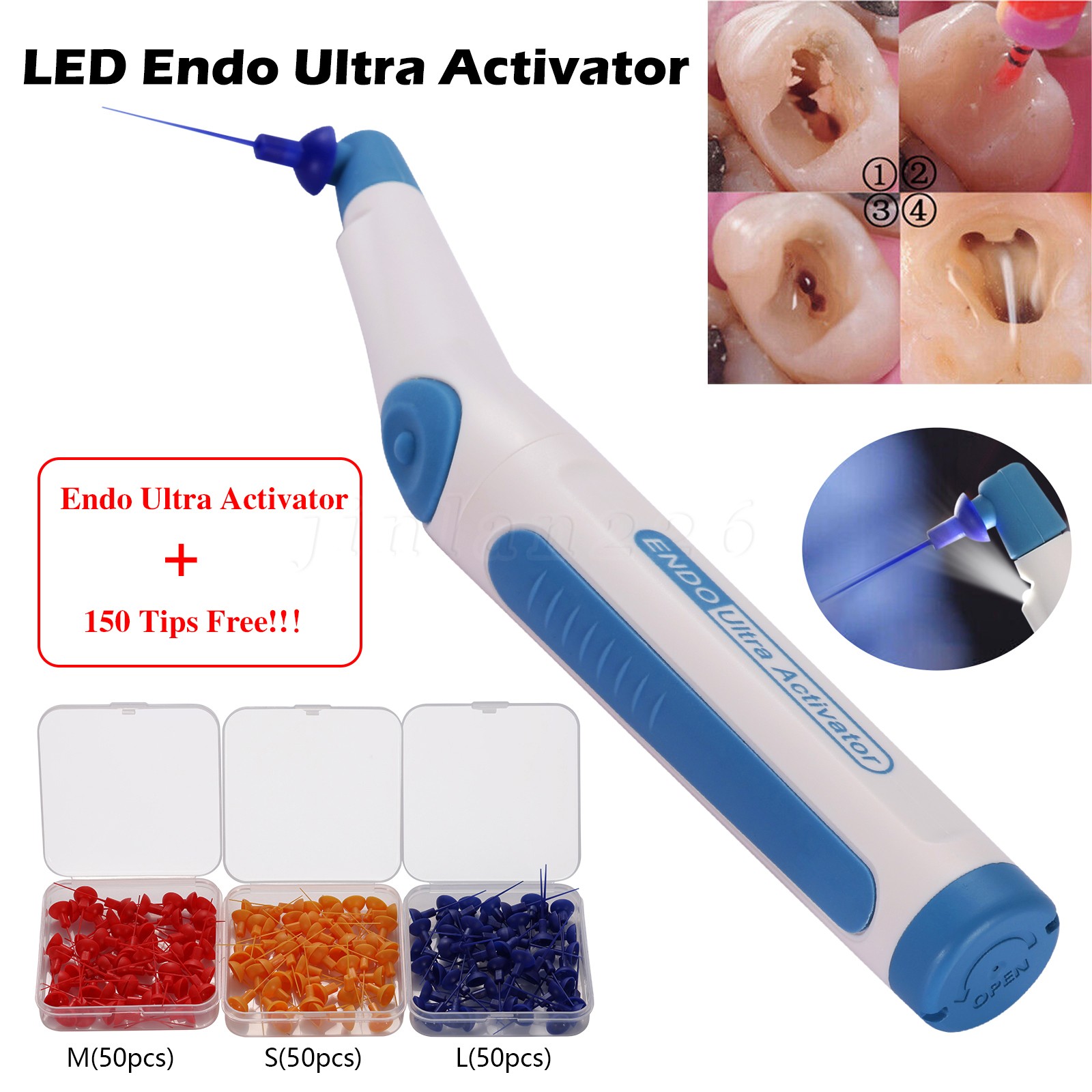 Dental Endo Ultra Activator Ultrasonic Irrigator Root Canal Handpiece 150 Tips