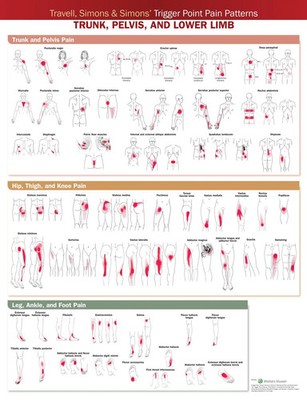Anatomical Chart Company | Travell, Simons & Simons' Trigger Point Pain...