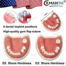 US Dental Implant Model Drilling Training Open Suture Dentistry Teaching Demo