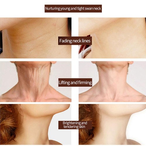Tighten and Lift Neck Cream, Pure Neck Firming Cream - Best For Tightening Q7E9 - Picture 10 of 12
