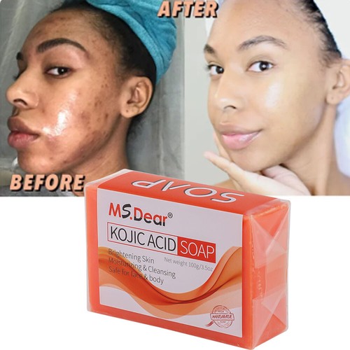 Kojic Acid Soap Dark Spot Remover Skin Lightening Face Whitening Body Bleaching - Picture 16 of 18