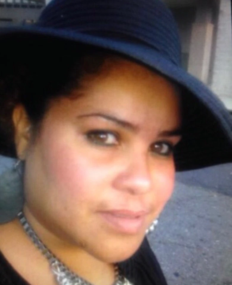 Sammy Skincare Dark Spots Remover Cream Extra Strength, 2oz Per Unit. - Image 4 of 4