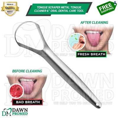 DAWNPROMED Tongue Scraper Metal Tongue Cleaner 6" Oral Dental Care Instrument German Grade