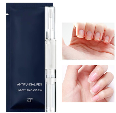Clinq Labs Antifungal Pen Fast Relief for Fingernails&Toenails,Quick-Absorbing