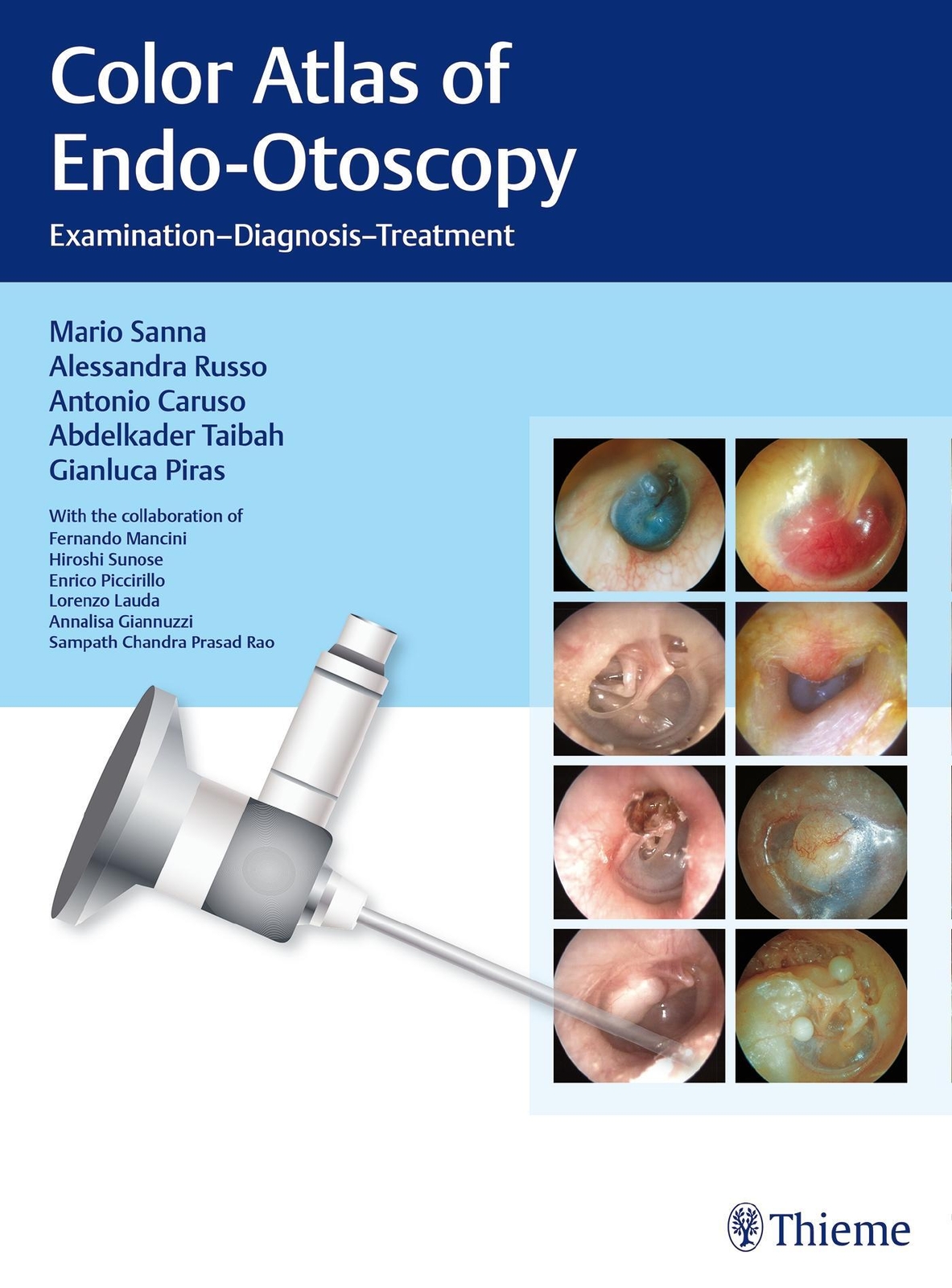 Thumbnail - Color Atlas Of Endo-otoscopy | Mario Sanna (u. A.) | Buch | 348 S. |