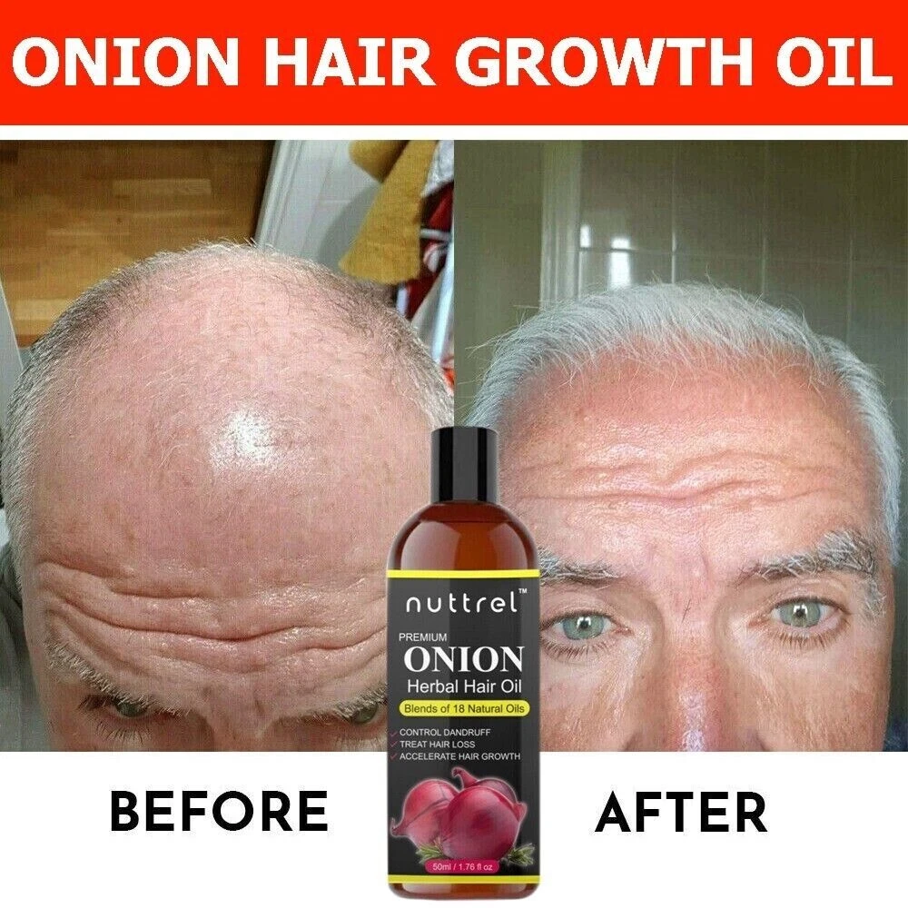 Update 158+ hair fall reduce oil super hot dedaotaonec