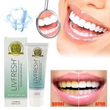 LIVFRESH Toothpaste Gel Clinically Proven to Remove Plaque 250% Better TL