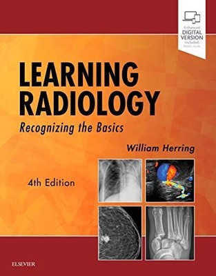 Learning Radiology: Recognizing the Basics by Herring MD FACR, William