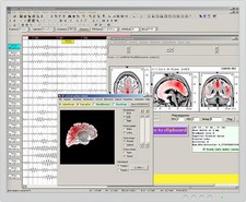 WinEEG software ADVANCED by MITSAR for eeg and qeeg analysis
