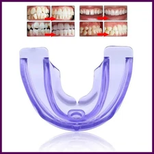 Myobrace Tooth Orthodontics Braces Veneers Anti Molar