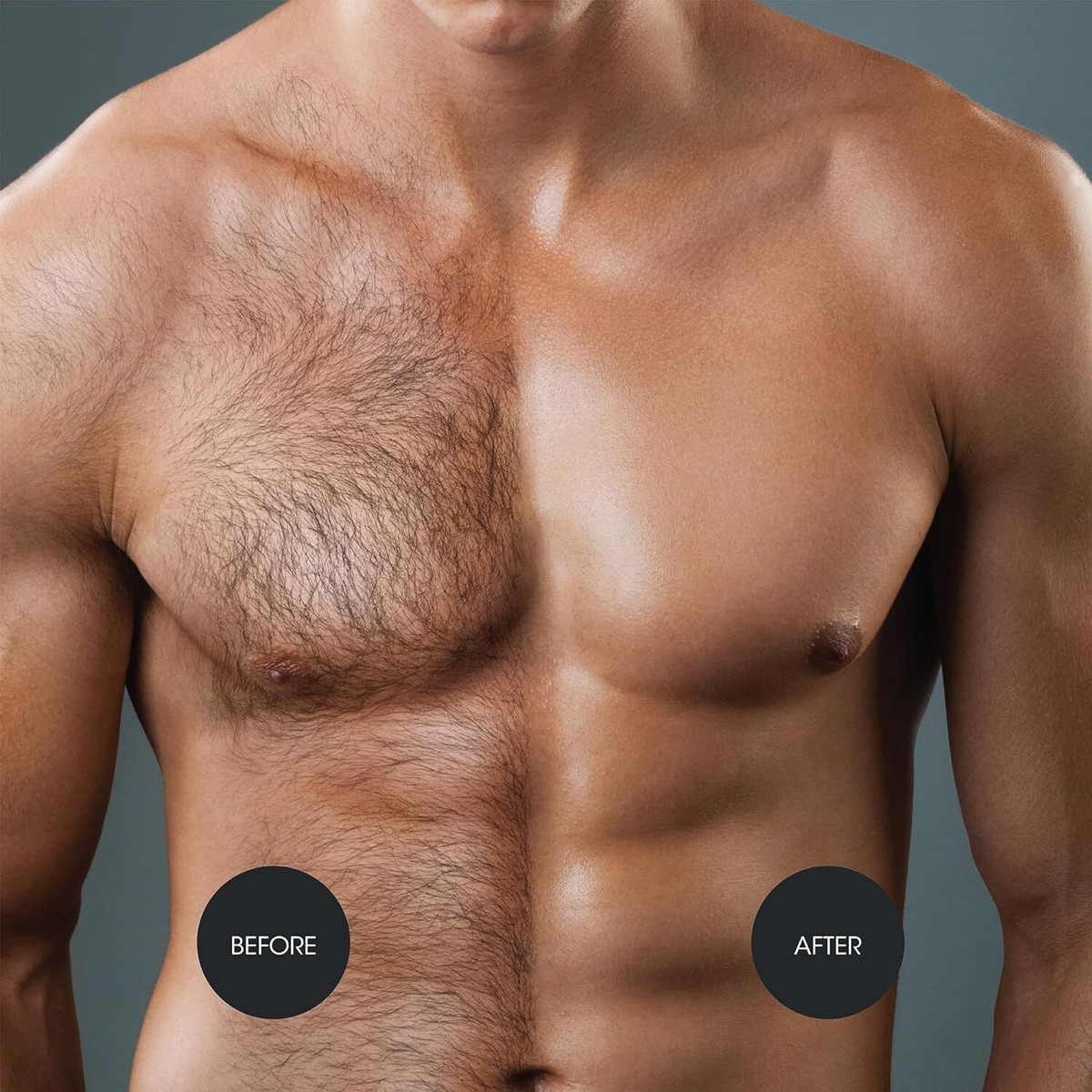 Depilación Láser Es Bueno Depilarse El Pecho Depilación Definitiva