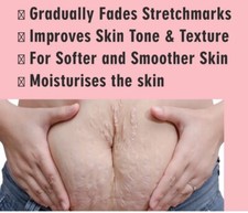 Stretch Mark Repair Cream - Postpartum Pregnancy Scar Remover & Skin Care Soluti