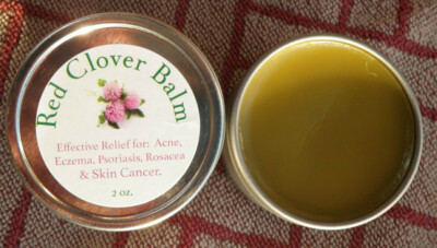Red Clover Balm - Relieves: Acne, Eczema, Psoriasis & Skin Kan-ser*    2 oz. 