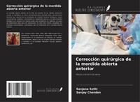 CorreccióN QuirúRgica De La Mordida Abierta Anterior Sanjana Sethi