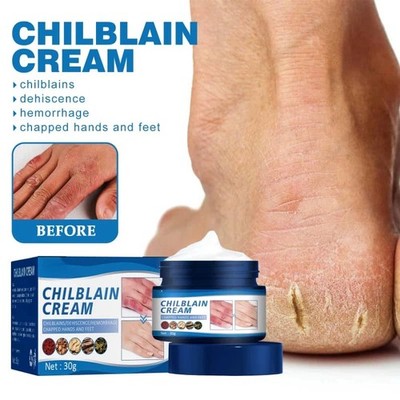 Moisturizing Foot Care Balm Cracked Foot & Callus Removal Fungus Treatment 30g