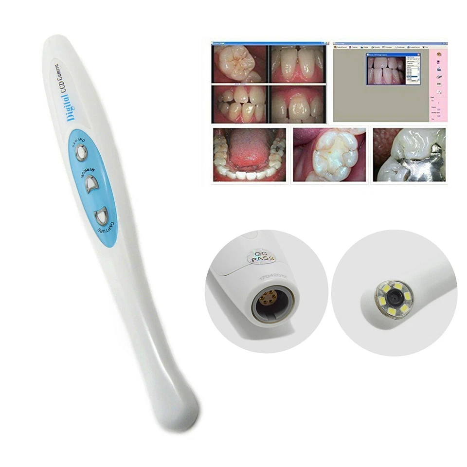 USB Observation Camera 1/4" Sony CCD Oral Camera with Mirror Function MD-960U US - Image 2 of 4