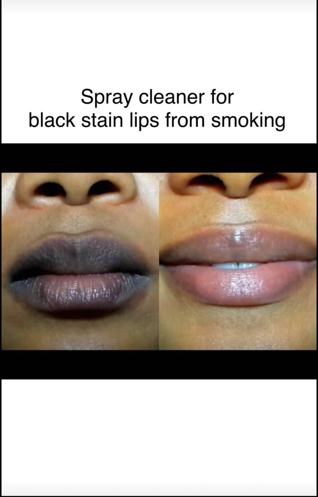 Black Lips Smoking Weed