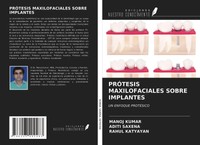 Manoj Kumar (U. A.) | PrÓTesis Maxilofaciales Sobre Implantes | Taschenbuch