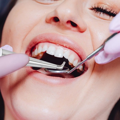 Pistola de chorro de arena microetcher pulidora dental de flujo de aire 1-10 profijo de 4 agujeros - Imagen 16 de 22
