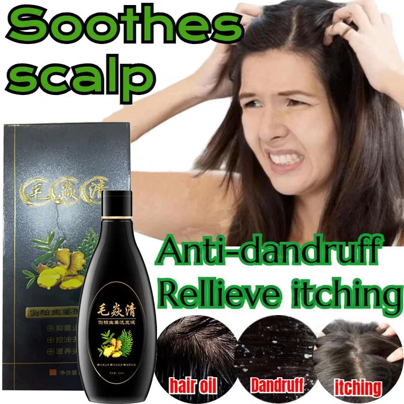 Шампунь 2024 Scalp Hair Follicle антибактериальный против зуда клещей масло контроль сделано в США - Изображение 2 из 4