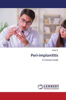 Peri-Implantitis A Concise Guide Rohit S. Taschenbuch Englisch 2021