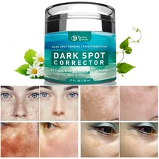Dark Spot Remover for Face, Hyperpigmentation, Melasma, Freckles, Sun Spots