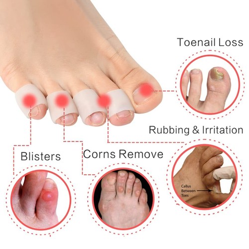 2) Stck. Silikon Gel rosa Zehenpartie Hülsen Schutz Abdeckungen für Blister Hammer Zehen - Bild 4 von 9