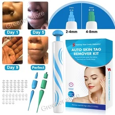 Natural Painless Auto SKIN TAG Removal Kit Skin Tag Bands Remover Device Auto