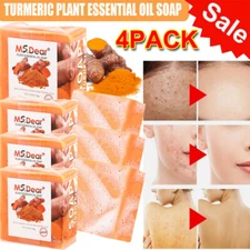 4× Turmeric Soap Skin Whitening Dark Spots lightening Acne Brightening Turmeric
