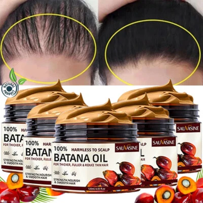 SAUVASINE 5/3PCS Batana Oil For Hair Growth, Natural Botana Oil Cream Hair Loss Treatment