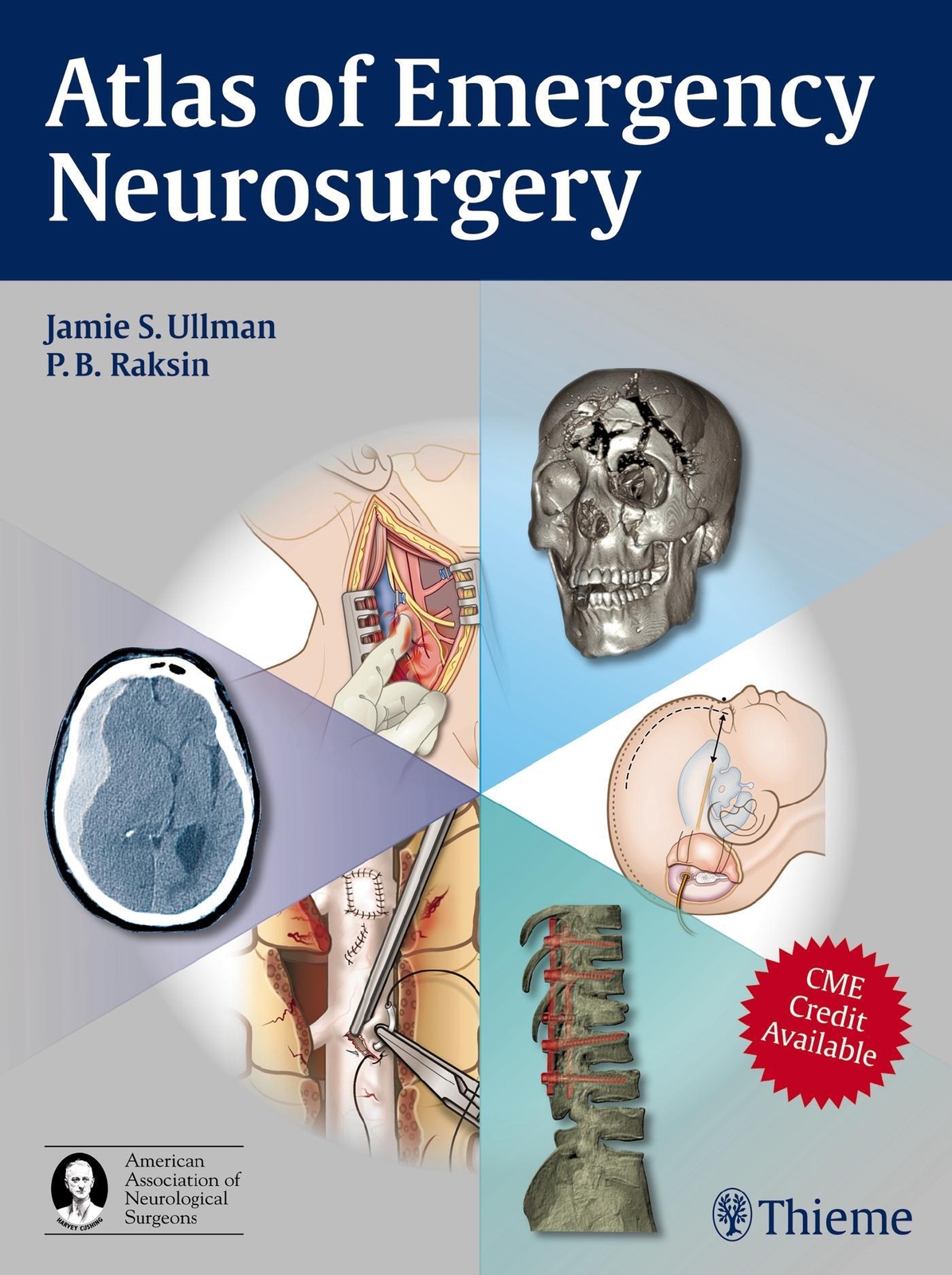 Thumbnail - Atlas Of Emergency Neurosurgery | Jamie S. Ullman (u. A.) | Buch |