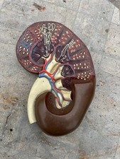 Vintage HUMAN KIDNEY model educational model Medical. Nephrology 1970s.