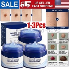 1 3PCS Skin Tag Spot Eraser Cream, Advanced Imperfection Removal Cream 50G