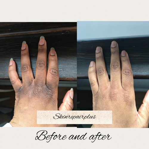 Crème SOIN Effaceur d'hyperpigmentation pour phalanges, pieds - Zdjęcie 4 z 17