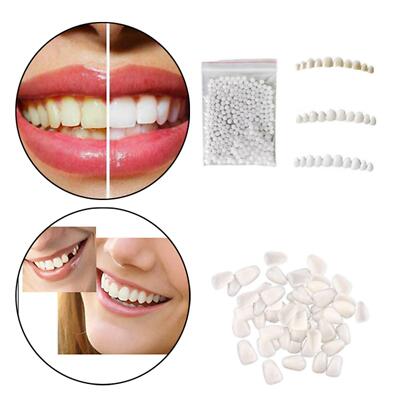 Obere & untere Zahnprothese Zähne Veneers für Männer Frauen temporäre falsche Zähne