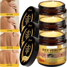 Bee Venom Skin Restoration Cream, Professional Bee Venom Skin Treatment Cream US