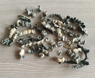 Dental Schrott Zähne Brücken 215 Gramm